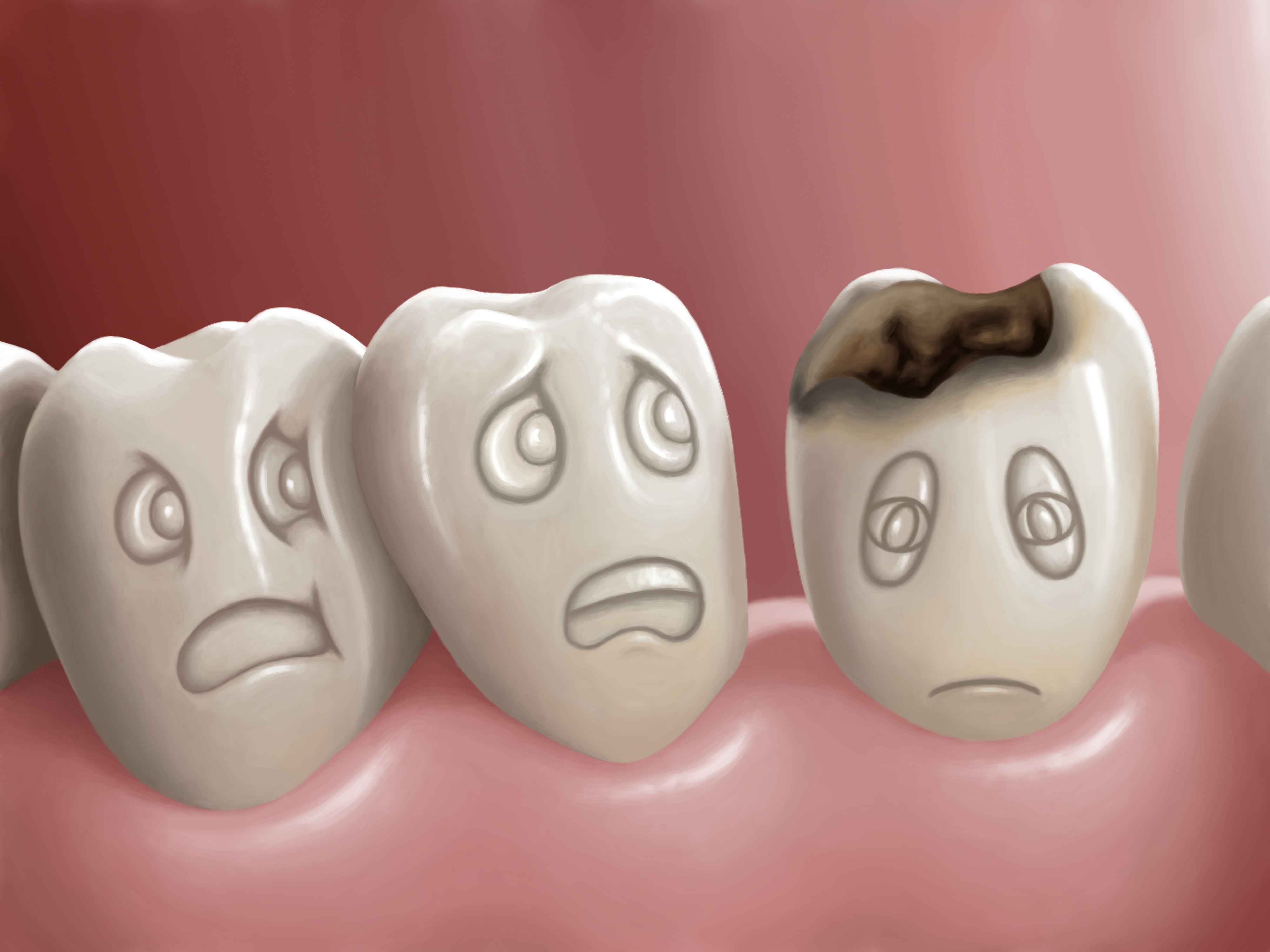cartoon image of teeth looking at a sad tooth with a cavity